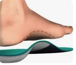 Pieds plats chez l&rsquo;enfant : faut-il s&rsquo;inquiéter ?