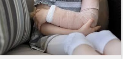 Fractures chez l’enfant : attention aux apparences !