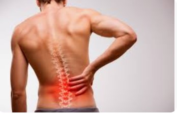 Le spondylolisthésis : un glissement vertébral